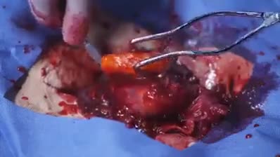 Mentions:  jesusisagoose verros anonchief kingoftheanonymous junifae bleachtaire  fjaggot wmmm twi ashadowguy mgsexplain deathklokiller silasersej nekubakeneko vzuse animedudej spoonerisms pcmihnea whaleegg  kingofunnyjunk reinbowxdash cooljason heartbleed 			**********		 keepyourselfalive blackanon myturbinmanprofssortwntyight bradleydoom vgmddg totallynotlegit omicronperseieight kharmelion dasbrot mcburd acemplas maestroxevous pinecest gmrain tripleskit jeezloxxy hexproof hiddenquail tehbomb streamdream spaceparadox xxkittypowaxx siodmy longchildjones lolbobsquarepaints kombee deadmanlopez mikimowse kodac zutraxsi karmanp jovanlisac wolfiet stingbourne ozkavosh sergife arott cisdroidcommander lehberga nikolaier fittetjuven fuperbooper insaneiare culinaryexplain nightmareshadez phoenixprince malachicthulhu ministermax gentlemantoast xtrem thevaulthunter theswagisreal khaoticonefear vexaton theguynamedme darthmaldude animedudej vortix leldatskool sergife thejammer keplerx warzon manananggal Shole tevansroskos animedudej defski knaiff demonbreadofnorth stardude sarcasmgasm neeeeee mrjweezy erikths plerp kriml diobrandolover supahsayin uifilms manananggal unfitninjuh doomeythekink ultiomos gazrick monkeybrains dbBlues ministermax captanyonomus ravemouse ipwnallnubz roxasftw lickmeforfree AWESOMEJANDRO mrsauce bossguycumsplash calvintroll severepwner alphagex nighthawxx lokkeduen kouzan hugovieira nekomimichan ledane chucknorrisisreal doblade boomerpyro norwegiansnowman doodooda upyourspal aerys stilch akulakhan xengard sirstupidpanda gloriouschad kightofnever whyheloitisijimble chinchulines warioteam shyyguy deadpoolrulez falcontreeko putinlover theseqceeman prtnchad stianan prohibullion mistermuppet MrKittyKat futaprincess donbionicle zoroso thecraftedmin bossguycumsplash spawnconnery jicajijipi xxkillaxx changedlater superpianobros bluslenderman awesomedoge MortalNME neppy xxkillaxx leondude auda epicbanjoman epicactual afrodemon onlylettersyousay tehbomb windbound manananggal mulk ymsinnmast cackrel mikasuh atonial thickfingers joekerr    
   
Reply here if you want to be added!    
   
Previous comp: /channel/dank-webms/Random+stuff+i+found+part+22+saxamophone/MnBfLZa/   
Bonus Comp: